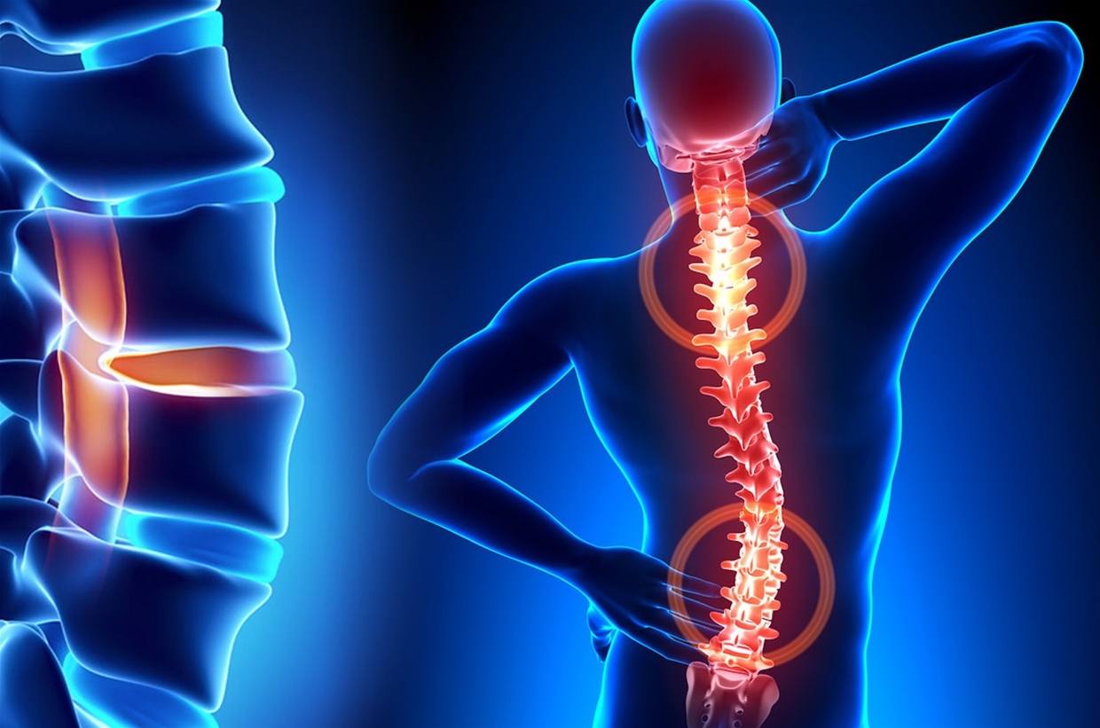 The Spine